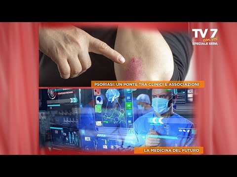 TV7 CON VOI SPECIALE SERA DEL 4/10/22 (3 DI 7) - Psoriasi: un ponte tra clinici e associazioni