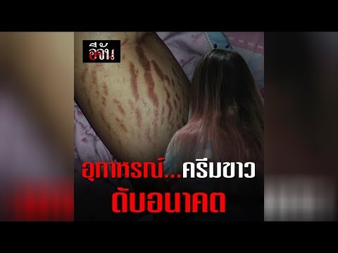 ที่หายคิดเห็นกลาก วินิจฉัยแยกโรคผิวหนังภูมิแพ้