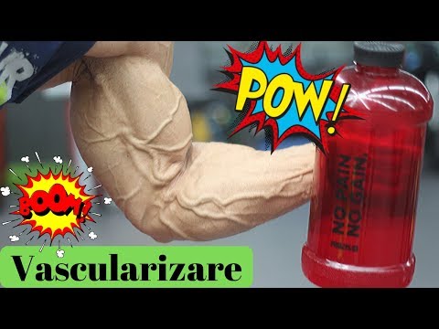 stadiul de pornire al preparatelor varicoase