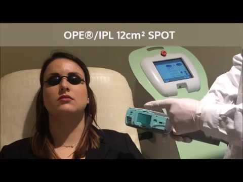 Prostata gdpzh Prostatite negli uomini Warmer