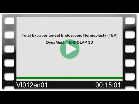 DynaMesh®-ENDOLAP 3D - OR-Video: Total Extraperitoneal Endoscopic Hernioplasty - TEP
