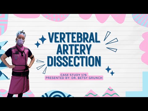 𝐂𝐚𝐬𝐞 𝐬𝐭𝐮𝐝𝐲 176 - Vertebral artery dissection
