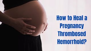 How to Heal a Pregnancy Thrombosed Hemorrhoid?