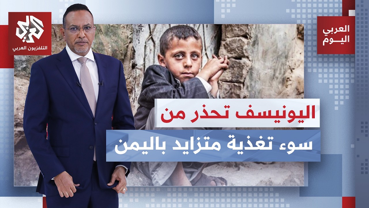 تحذيرات من منظمة اليونيسف من حالات سوء تغذية حاد بين أطفال اليمن.. إلى أي حد ي?