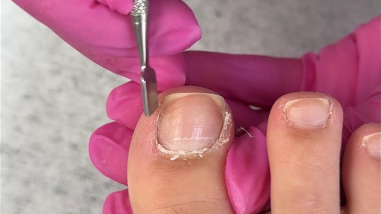 Transformação das unhas dos pés (Passo a passo completo)