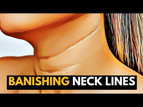 All About Allergy Shots