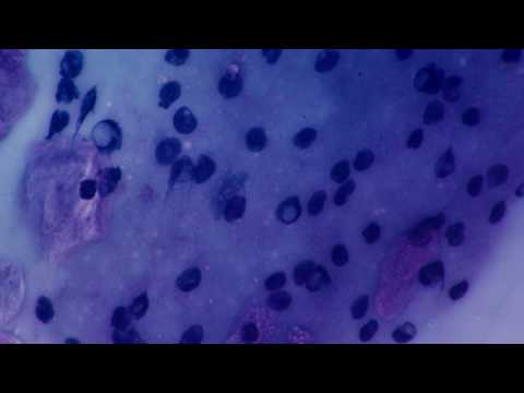comment traiter molluscum contagiosum