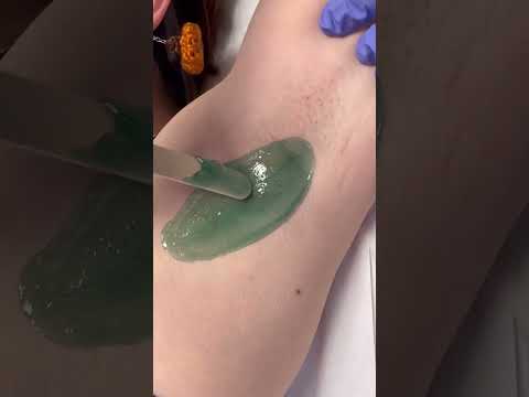Professional waxing of short under arm hair using hard wax from nacach #esthetician #waxing