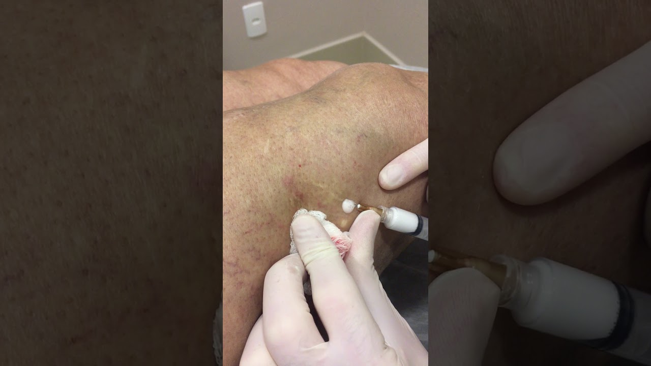 Jaison Luiz Argenta-10