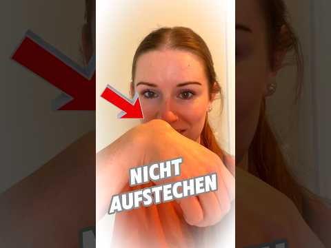Bibelzyste Erklärt 😳✋ #shortvideo