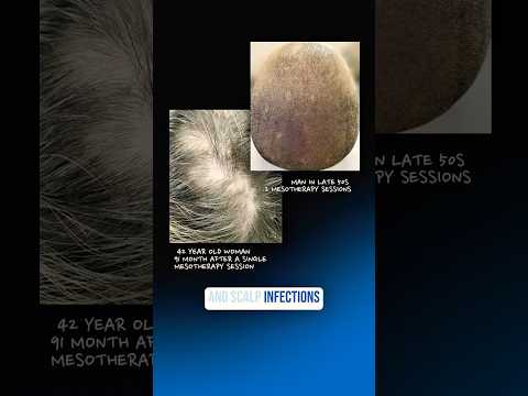 Dutanol 0.5mg Tablets