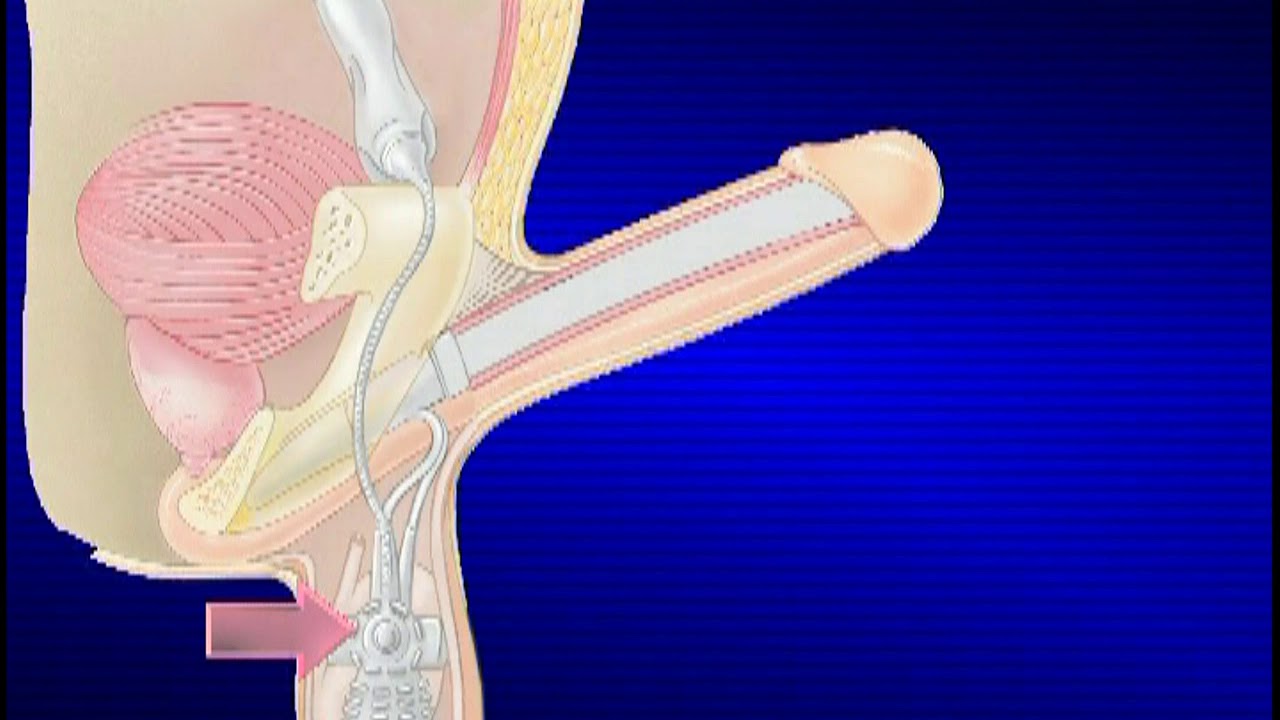 Luis Fernando Echeverry Molina-17
