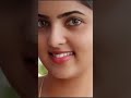 Radhika Preethi Cute Moments Zooming Images