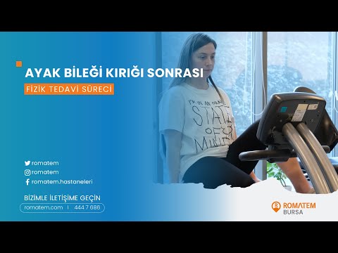 Physical Therapy & Rehab After an Ankle Fracture in Cyprus