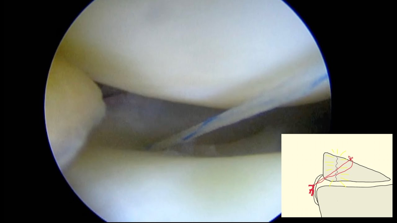 Urszula Zdanowicz-15