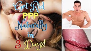 How to Get Rid of Pearly Penile Papules (PPP) Naturally, Permanently in 3 Days!