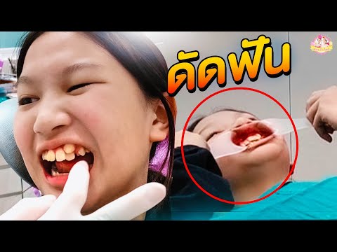 ฟีฟายแอดวาด