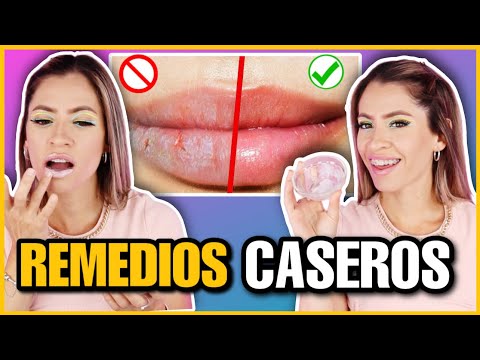 3 MASCARILLAS CASERAS PARA REPARAR LABIOS AGRIETADOS Y SECOS | NatyGloss