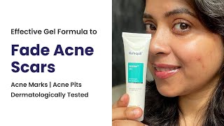 Effective Gel Formula to Fade Acne Scars|| Acne Marks || Acne Pits- Dermatologically Tested