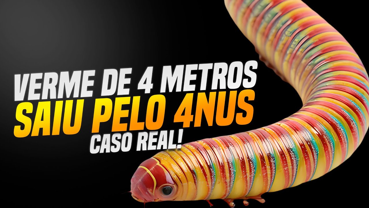 DR. FERNANDO LEMOS REVELA CASO REAL DE PACIENTE COM VERMES.