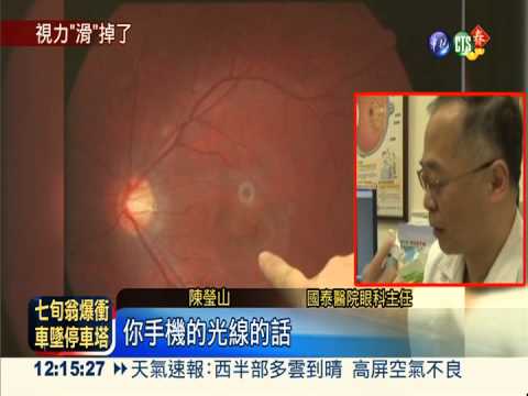 寒假老盯著3C 女大生左眼險瞎