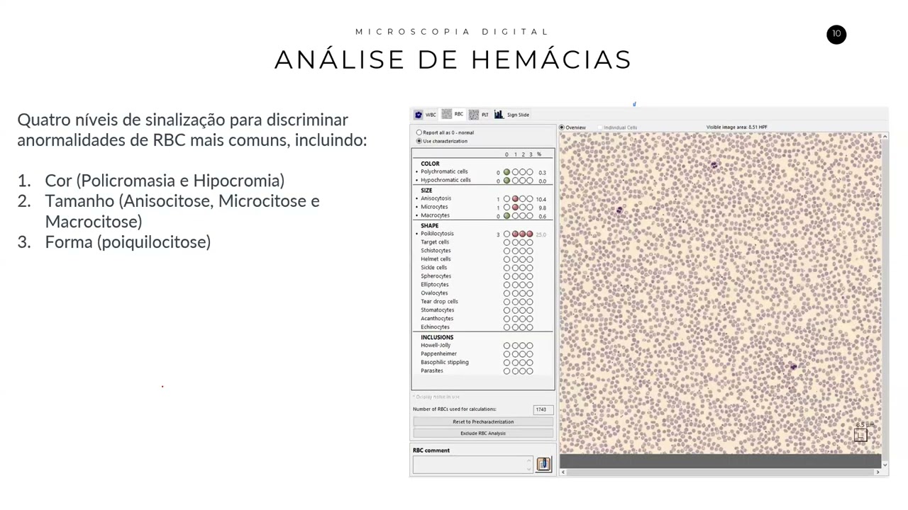 Microscopia Digital em Hematologia: Uma Análise Crítica da Experiência Brasileira