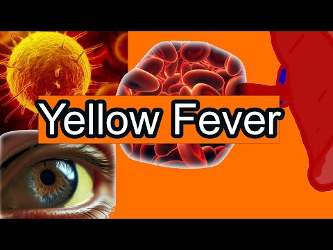 Yellow Fever Explained Simply: Symptoms and treatment