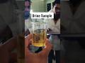 Urine Test Shorts Ytshorts Laboratory