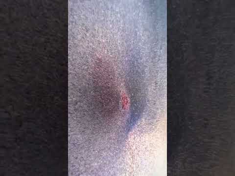 1 million zombies versus siren head