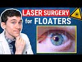 Laser Surgery For Eye Floaters Treatment Laser Vitreolysis