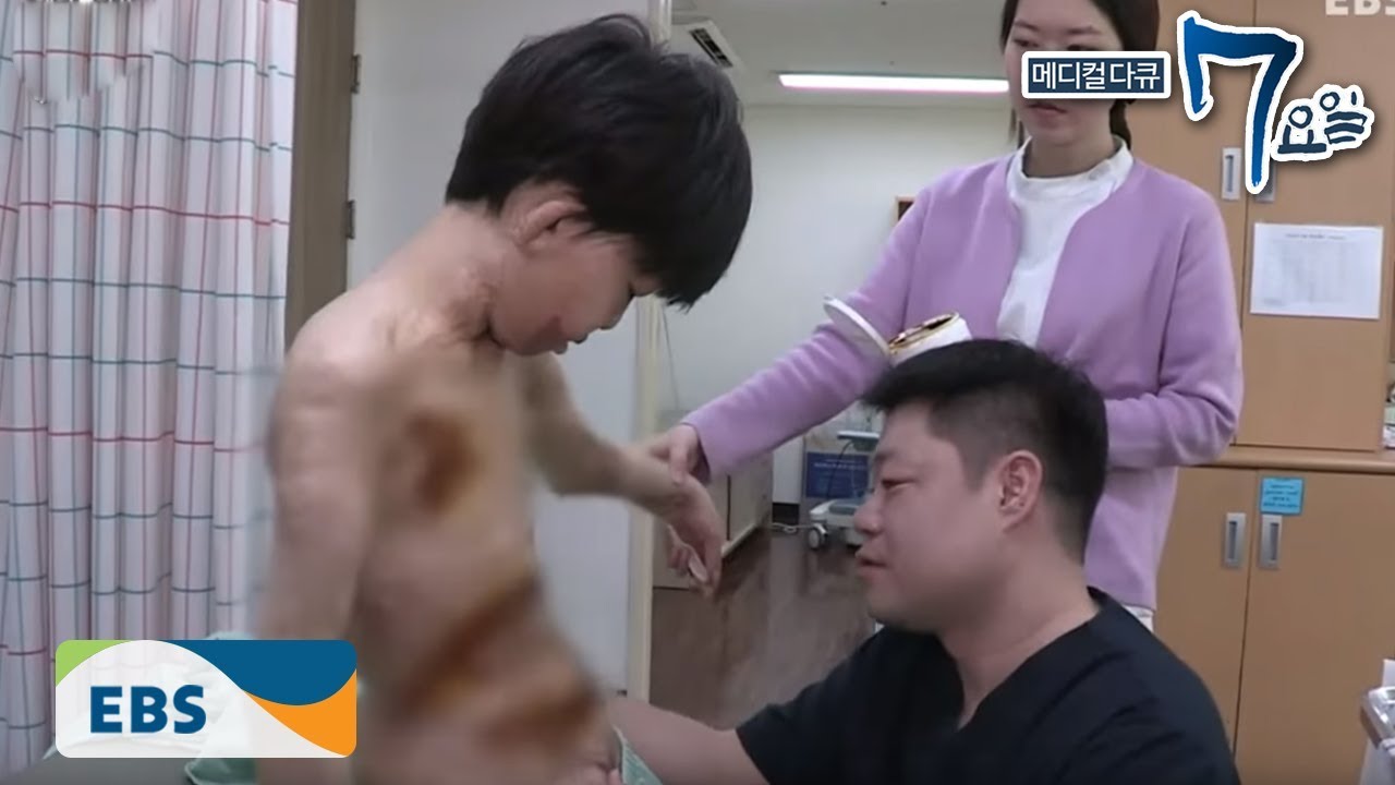 메디컬 다큐 7요일 - 엄마라는 이름으로- 3도 화상 외_#002