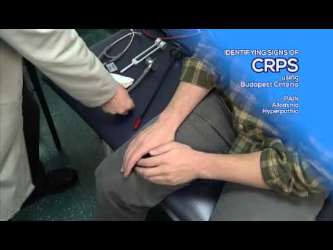 How to Diagnose CRPS by Utilizing the Budapest Criteria - RSDSA