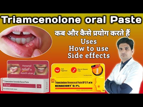 Triamcinolone Acetonide Dental Paste