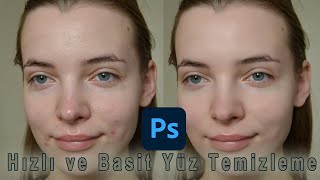 Photoshop Hızlı ve Basit yüz temizleme.
