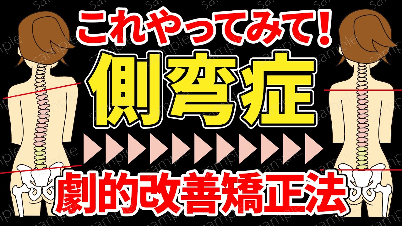 【側弯症】9割が知らない背骨の歪みやねじれを解消する方法【治し方】
