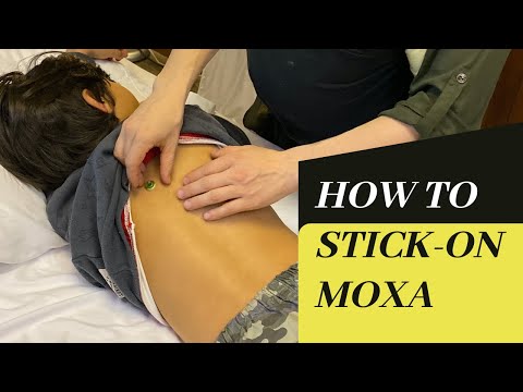 How to use stick-on moxa - for acupuncturists and patients