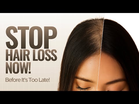 Why You’re Still Losing Hair (Even After Trying Everything) | Dr Yusra