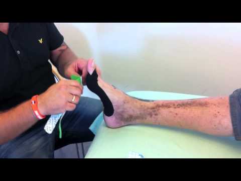 comment poser kinesio tape