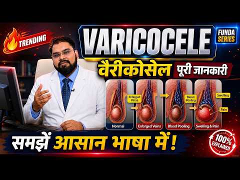 Impact of Bilateral Varicocele on Sperm Count video