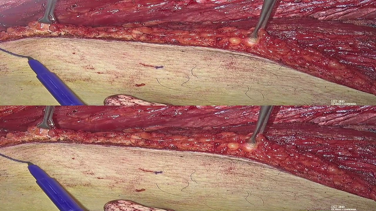 Armando De Virgilio-1