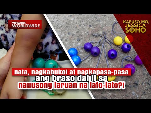 Bata, nagkapasa-pasa ang braso dahil sa laruan na lato lato?! | Kapuso Mo, Jessica Soho