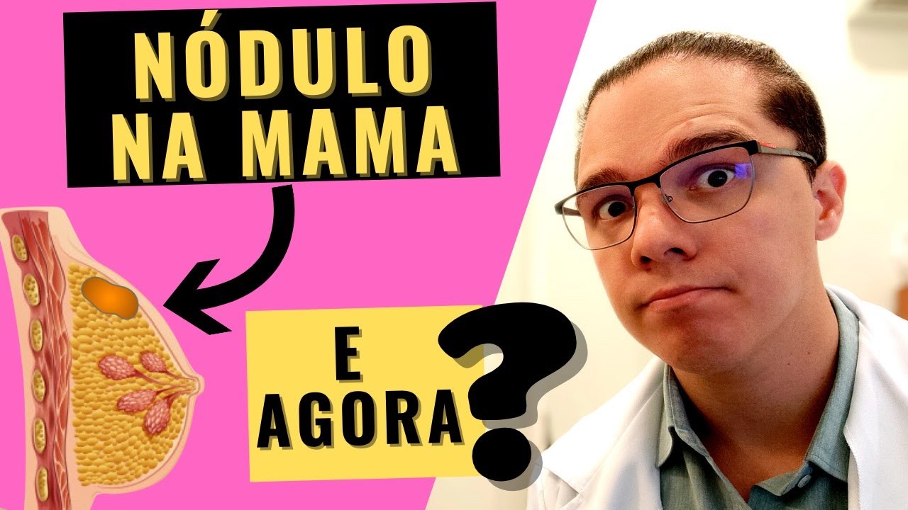 NÓDULO NA MAMA QUE DOI É CÂNCER? Entenda a diferença de um nódulo benigno para um maligno na mama!