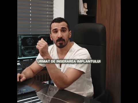 Cât durează tratamentul cu Implanturi dentare?