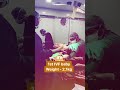 डॉक्टर द्वारा जुड़वा बच्चों की डिलीव�
