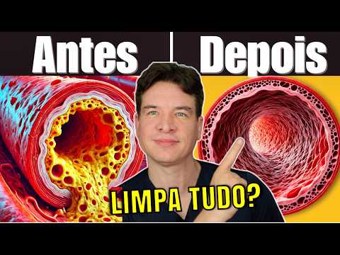 Discover the TEST that can save your heart – Are your arteries at RISK? (unclog your arteries)