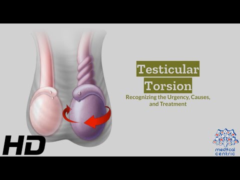 Effects of Cannabis on your body