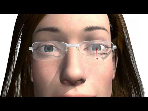 Fitting single vision lenses glasses correctly - important f...