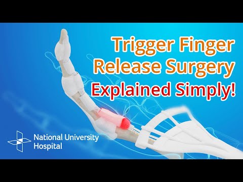 Trigger Finger Release Surgery - Explained