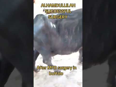 #mpd  #sarni #shernil#سرن #mpd YouTube shorts #before MPD surgery in buffalo #after MPD surgery
