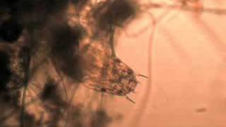 preview picture of video 'Chironomid larvae'